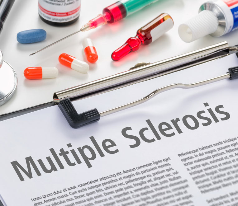 Multiple Sclerosis Ms Symptoms And Treatment