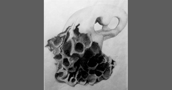 Sharing the Pain: Expressing Feelings Through Art